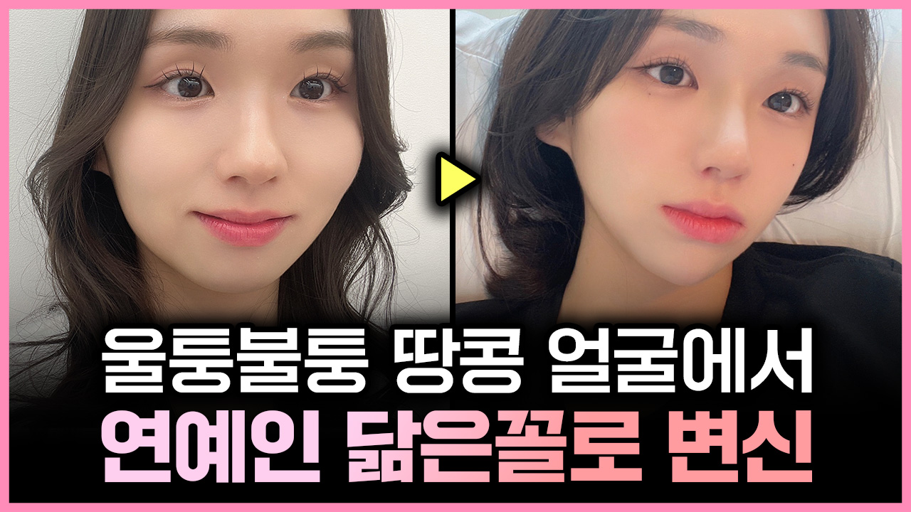 예쁨페이스라인