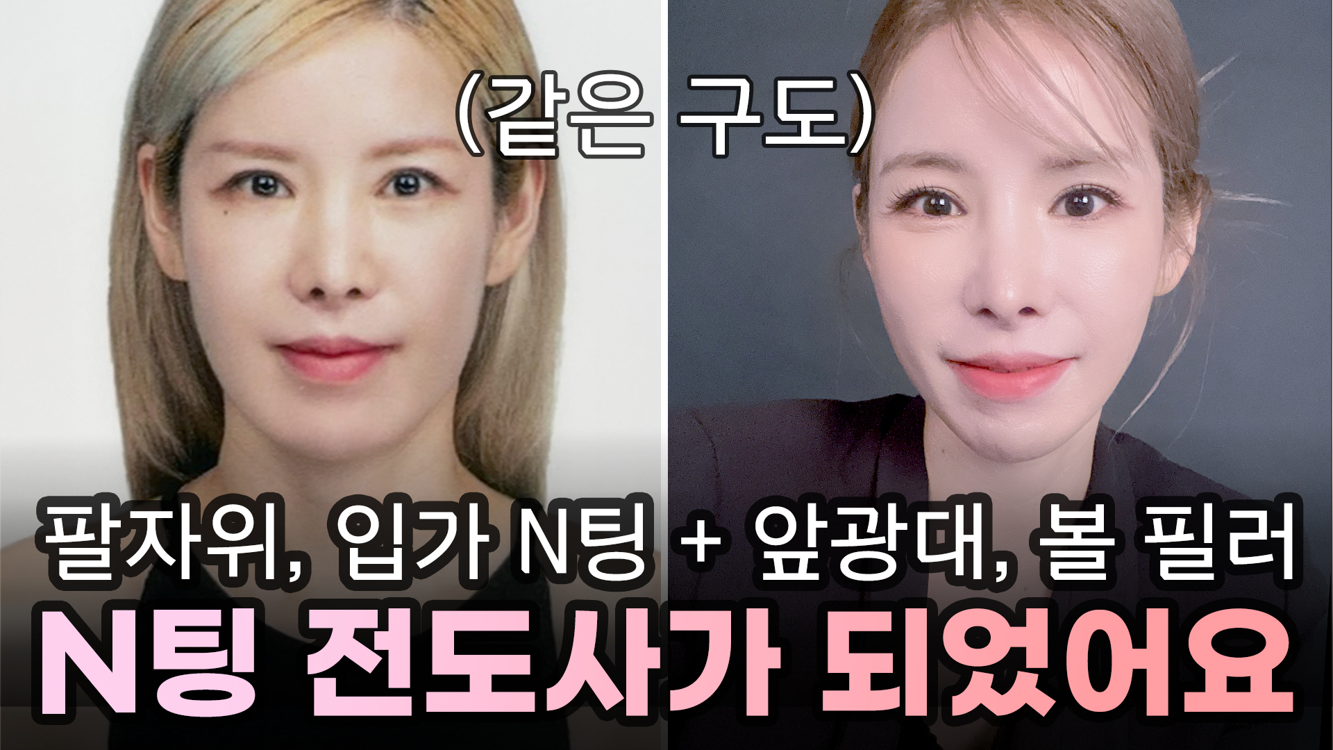 예쁨페이스라인