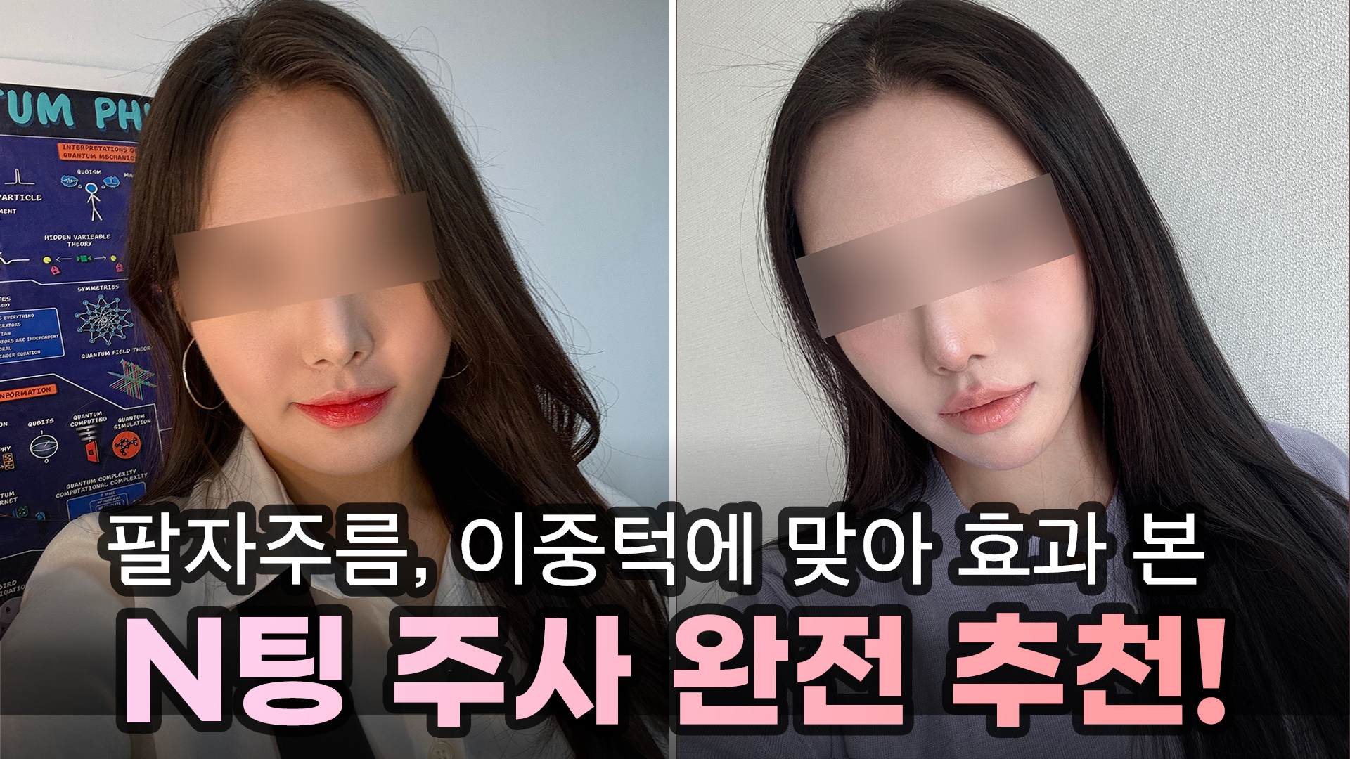 예쁨페이스라인