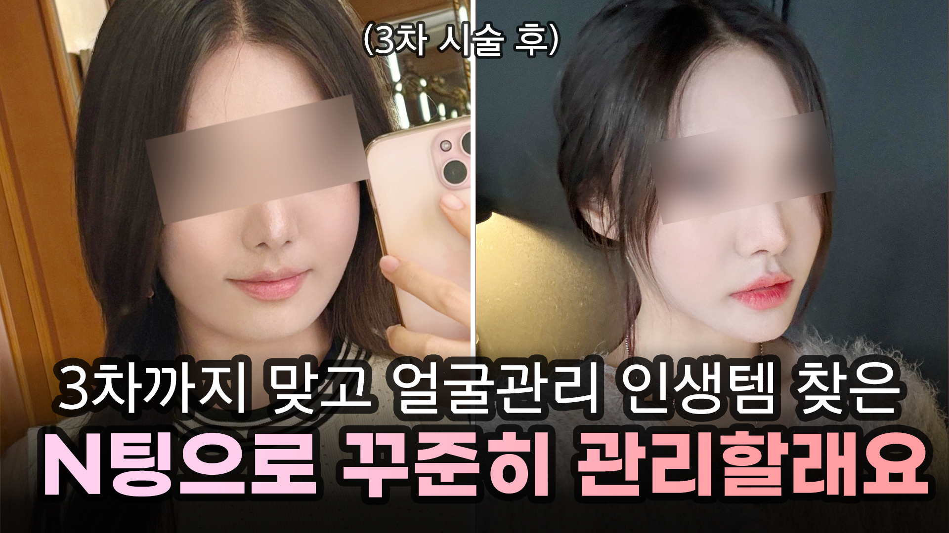 예쁨페이스라인